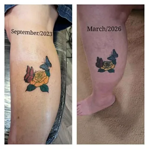 Yellow roses and butterflies on the calf, fresh in September 2023 and healed in March 2026