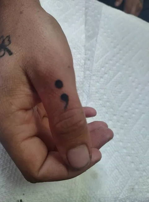 A semicolon on the side of the hand